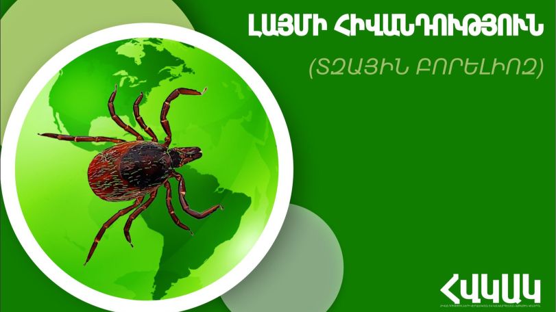 Ի՞նչ անել տզի խայթոցի դեպքում