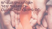 Սթրեսային իրադարձությունները կարող են բարձրացնել Ցրված սկլերոզի զարգացման ռիսկը 17–30%-ով