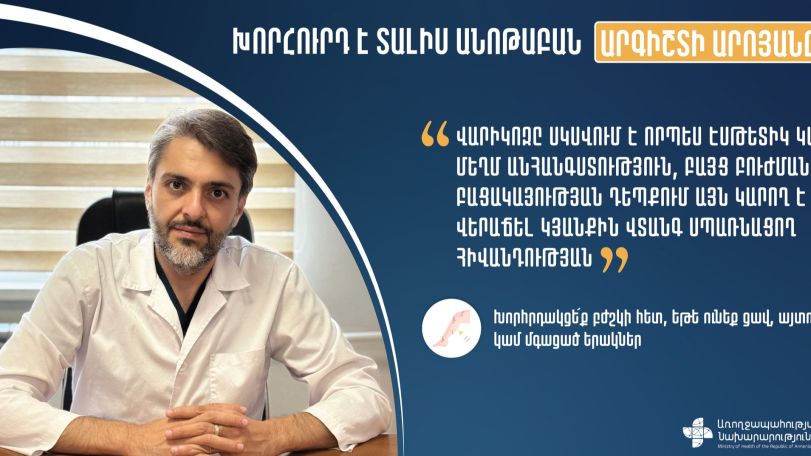Որո՞նք են վարիկոզի պատճառները. Ներկայացնում է բժիշկը