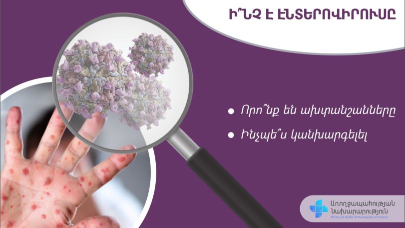 Ինչ է էնտերովիրուսը և որոնք են ախտանշանները