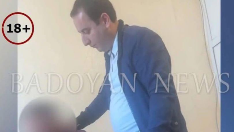 «Այս խոշտանգման ամենազարհուրելի մասը»․ փաստաբաններն արձանգանքում են ոստիկանի կողմից բռնության ենթարկված քաղաքացու դեպքին