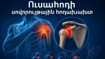 Ինչո՞ւ է առաջանում ուսահոդի հոդախախտը