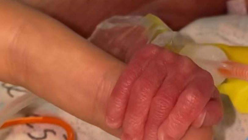 Mother and baby survive freak accident due to swift medical intervention in Armenia