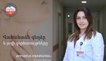 Ինչպե՞ս է յոդն ազդում վահանաձև գեղձի առողջության վրա. Էնդոկրինոլոգ