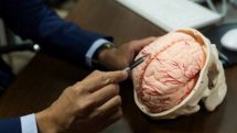Iran produces lab-grown artificial brain