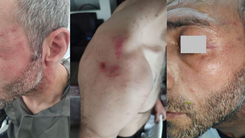 Armenian police accused of brutally beating man in Armavir