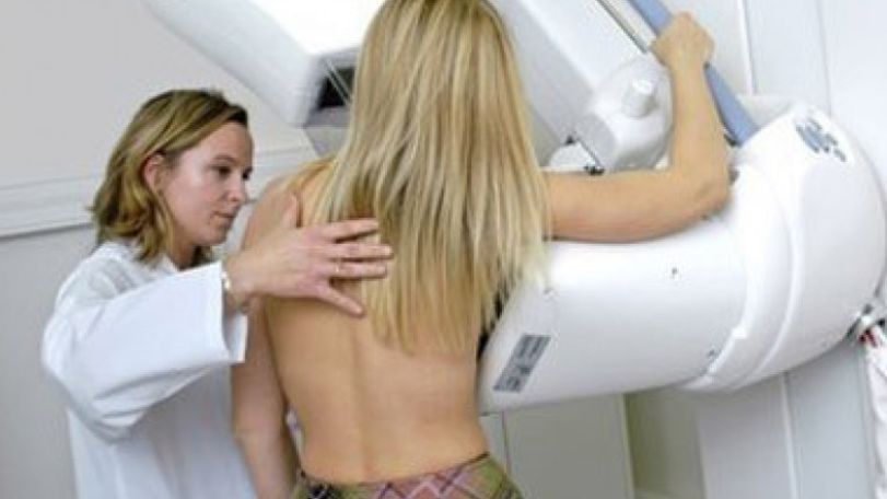 Half of cancer sufferers live another decade, study shows