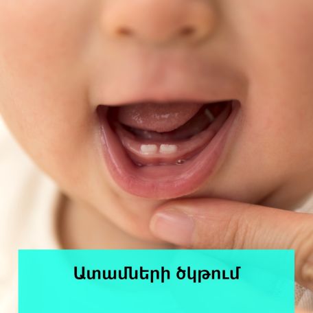 Պետք չէ արհեստականորեն փորձել միջամտել երեխայի ատամների ծկթման պրոցեսին