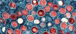 WHO on alert as mpox cases surge in Africa