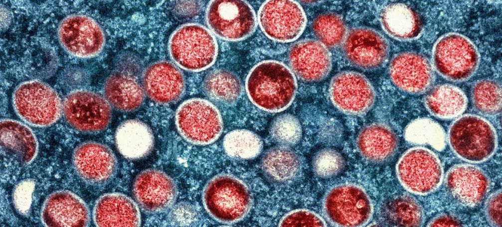 WHO on alert as mpox cases surge in Africa