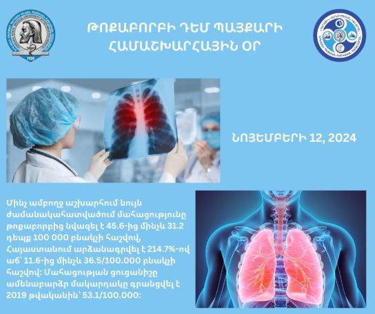 Armenia sees rise in pneumonia mortality rate