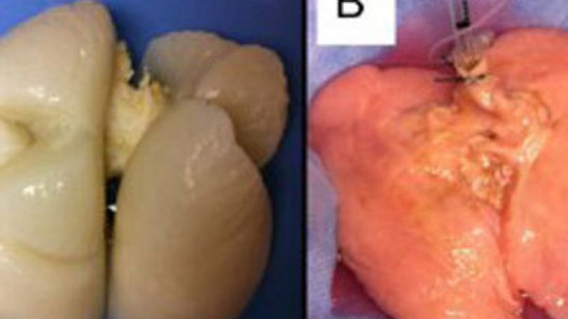 Human lung made in lab for first time