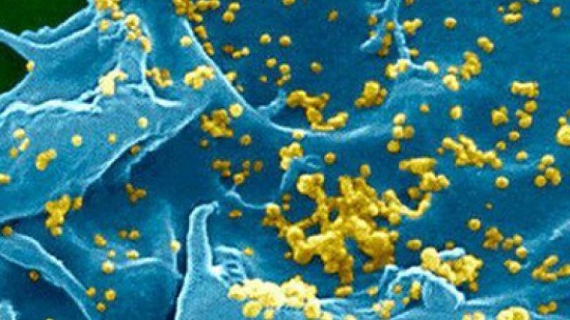 Sixth Mers death in South Korea amid sharp rises in cases