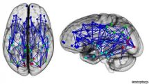 Men and women 'wired differently'