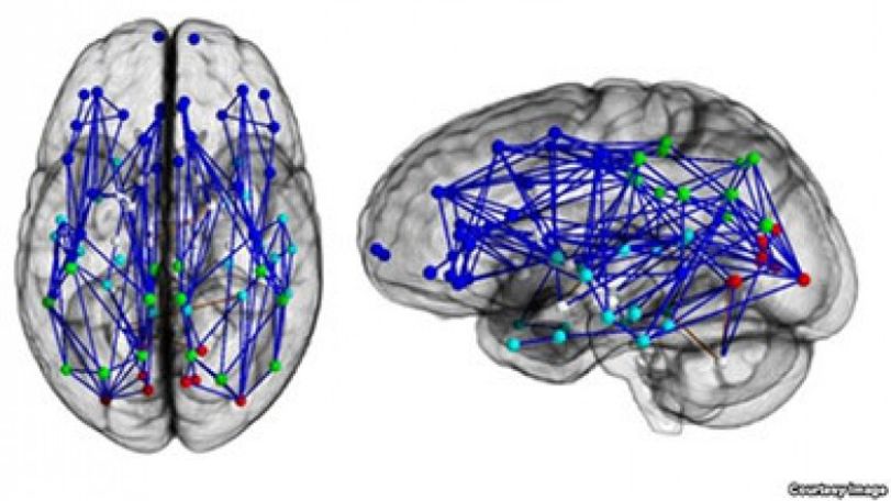 Men and women 'wired differently'