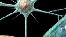 US patients in brain disease scare