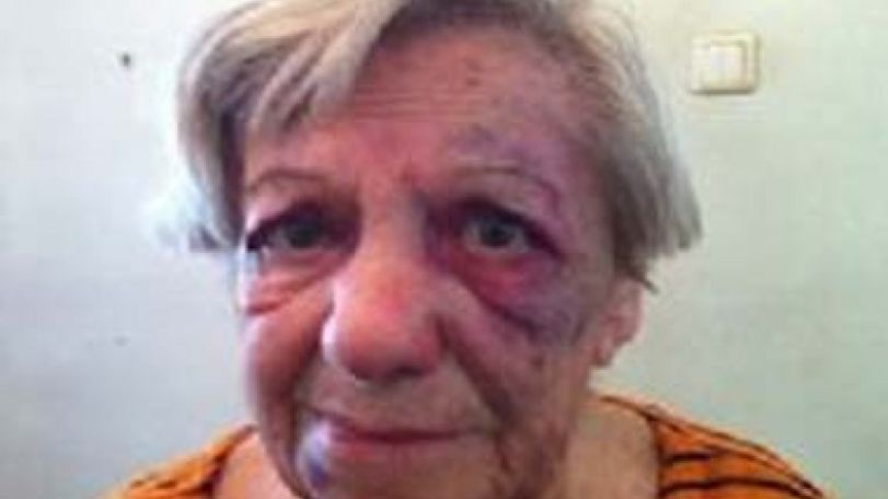 Another Armenian woman attacked in Turkey