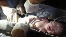 Chinese baby wedged in toilet pipe leaves hospital