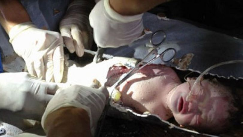 Chinese baby wedged in toilet pipe leaves hospital