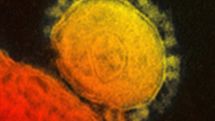 Dangerous virus diagnosed in France