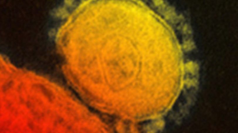 Dangerous virus diagnosed in France