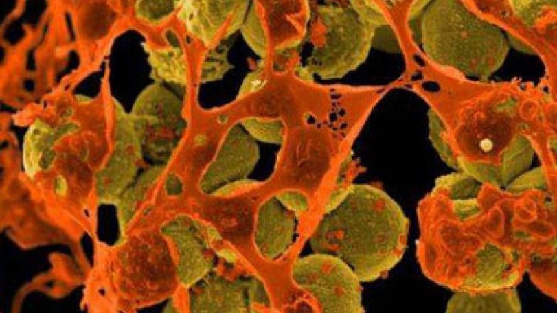 World failing in fight against antibiotic resistance – WHO