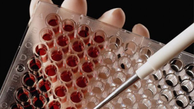 Health Ministry: Laboratory tests confirm anthrax diagnosis only for one patient 