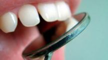 Yerevan to host Dentistry Conference in October