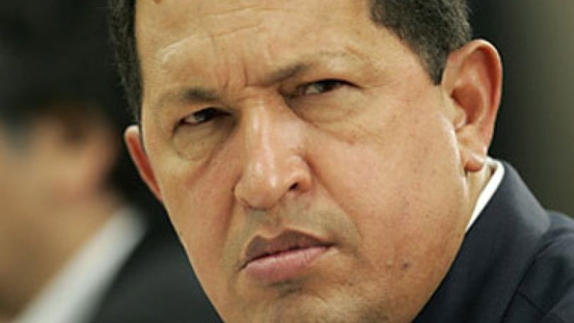 Venezuelan intensive care doctor Chavez has tumour with 3 metastasis