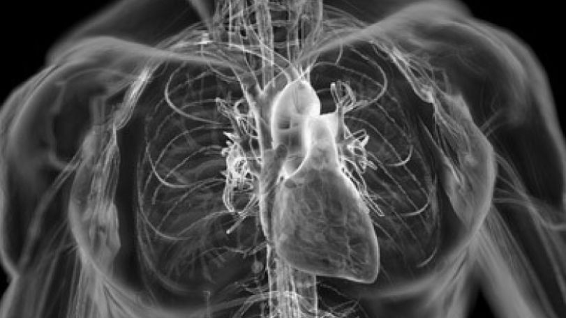 Cardiovascular diseases rule the death toll in Armenia  
