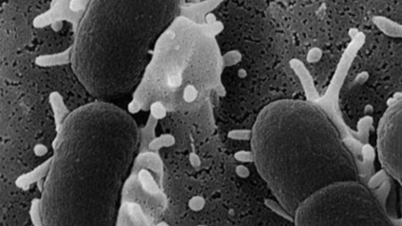 E.coli infection killed a 2-year-old boy in Germany