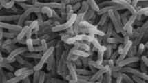  Cameroon: 300 people died from worst cholera outbreak