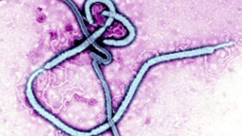 Experts: It is very likely that Ebola virus will spread through airborne particles 