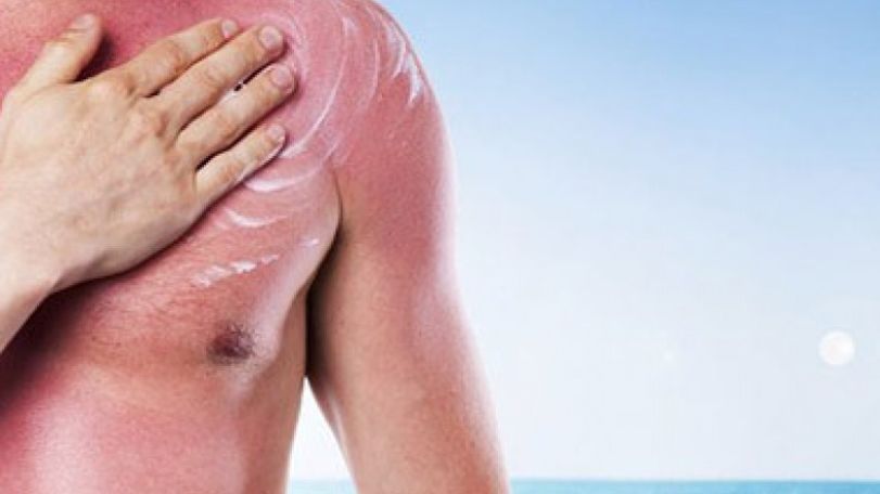 Sunlight continues to damage skin hours after exposure