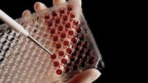 Experimental drug could be AIDS 'vaccine' breakthrough