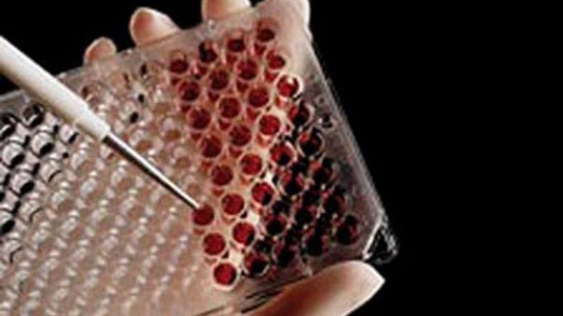 Experimental drug could be AIDS 'vaccine' breakthrough