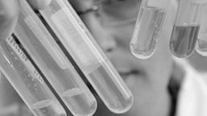 A/H1N1 flu toll hits 28 in Armenia 