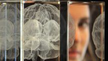 'Smart gene' associated with better aging and cognitive function in one in five people 