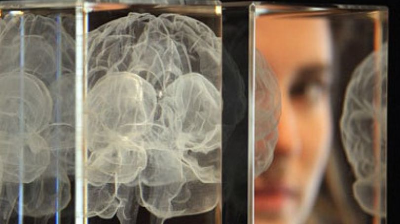 'Smart gene' associated with better aging and cognitive function in one in five people 
