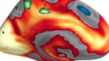 Male and female brains really are wired differently