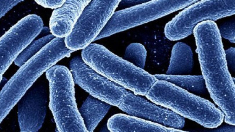 Superbugs to kill 'more than cancer' by 2050