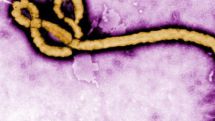 Ebola test offering 15-minute results on trial in Guinea