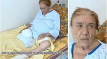После ампутации здоровой ноги пациентки азербайджанские врачи, наконец, ампутировали и больную