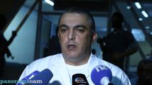 Врач прокомментировал слухи о возможном укорачивании больной ноги участника «Сасна црер» П.Манукяна