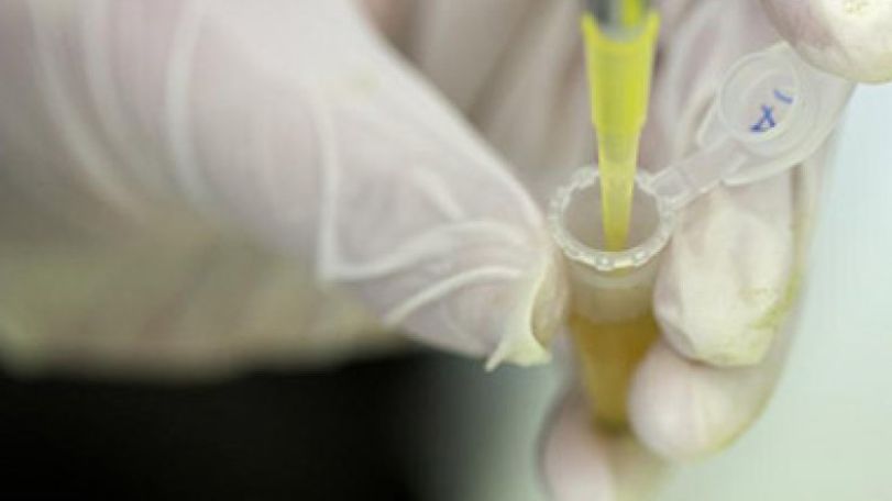 Russia to begin testing its Ebola drugs - Health Ministry