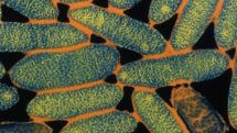 Portugal Legionnaires' disease outbreak kills five