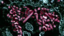 Ebola virus: Scientists discover DNA could determine if victims live or die    