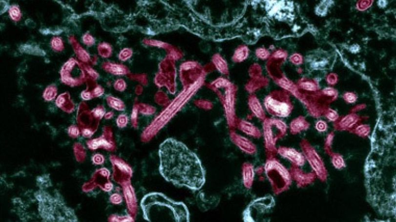 Ebola virus: Scientists discover DNA could determine if victims live or die    