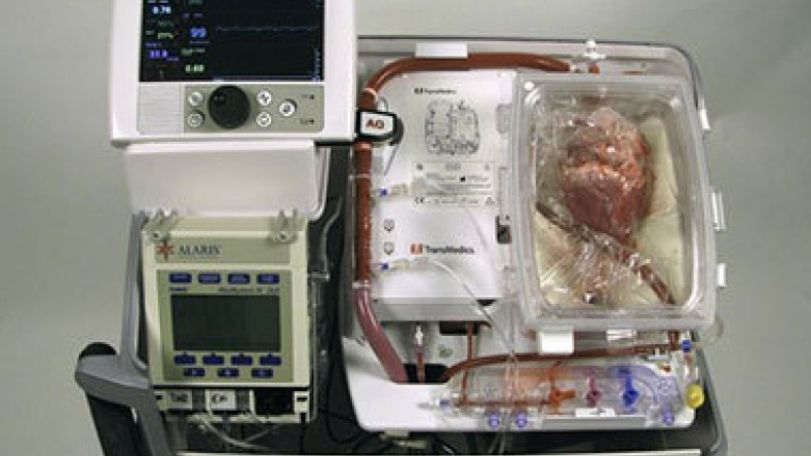Surgeons transplant heart that had stopped beating