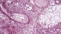 Cancer-killing cells made in the lab